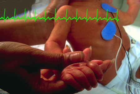 baby-heart-trace